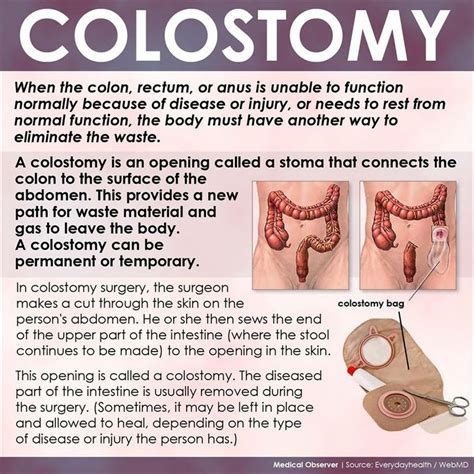 stoma tips meaning